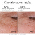 Retinol Anti-Aging Face Cream with Hyaluronic Key Ingredients & Active Formula Highlight