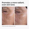 Glycolic Acid 7% Exfoliating Toner for Key Ingredients & Active Formula Highlight