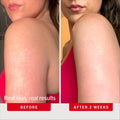 How to Apply AHA 10% Body Scrub for Keratosis – Skincare Routine Demo