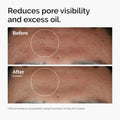 Niacinamide 10% + Zinc 1% Serum Texture Swatch – Formula Close-Up | Lumeal California