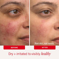 How to Apply Colloidal Oatmeal Body Cream for Eczema – Skincare Routine Demo