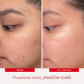 How to Apply AHA + BHA Exfoliating Face Pads – Skincare Routine Demo