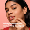 Original Hydrocolloid Acne Pimple Patches for Packaging & Full Ingredient Label | Lumeal CA